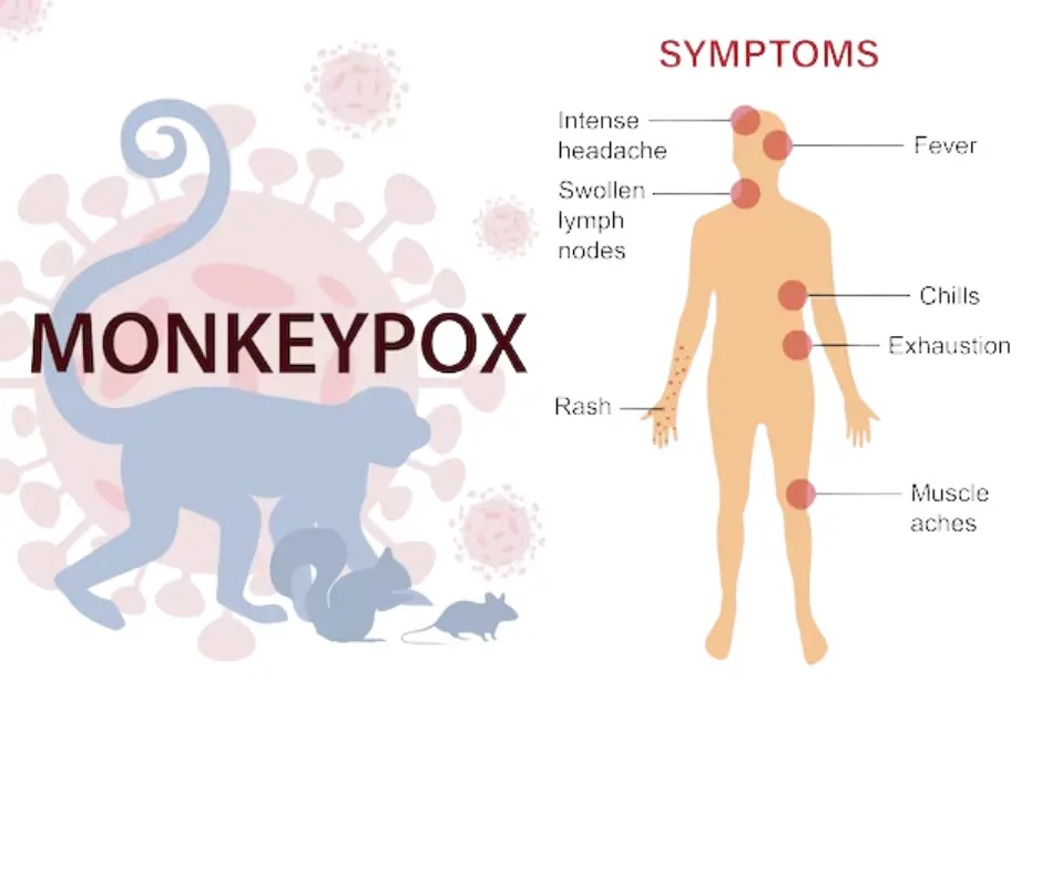 Symptoms of Monkey Fever